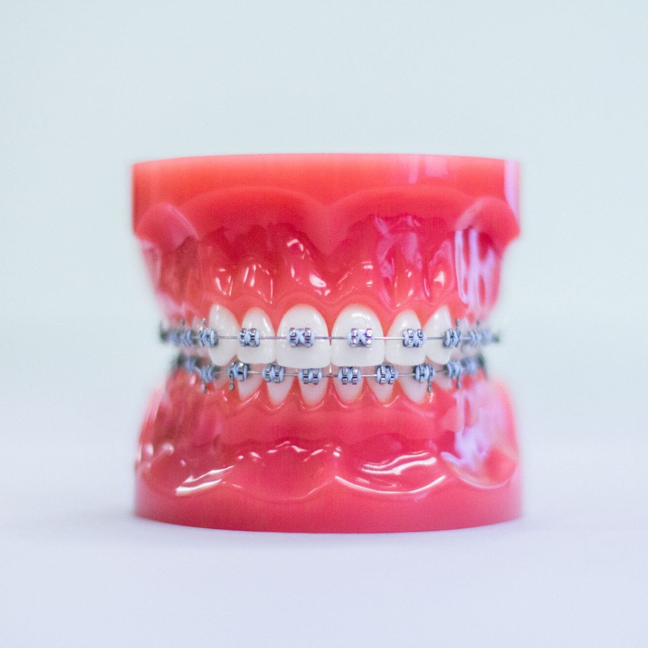 invisalign south bay